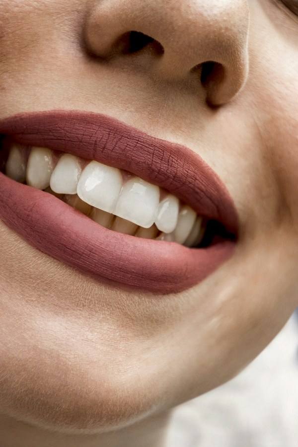 Lentes de contato dental na Iso Angra